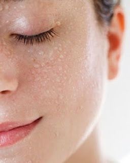 What is BHA?
