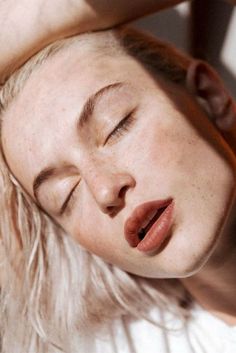 Open pores and blackheads: what to do?