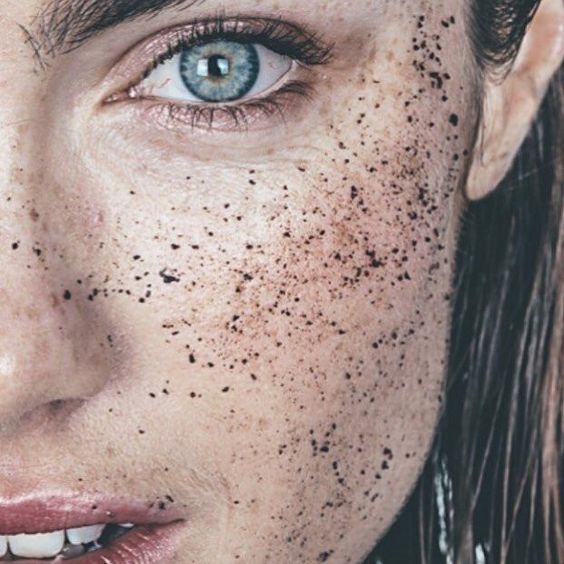 How to prevent and treat blackheads?