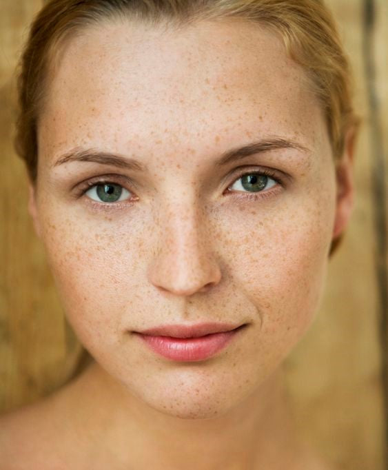 How to get rid of dark circles under your eyes?