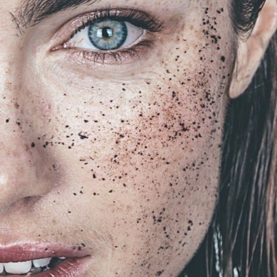 How to prevent and treat blackheads? - Australian Skin Institute